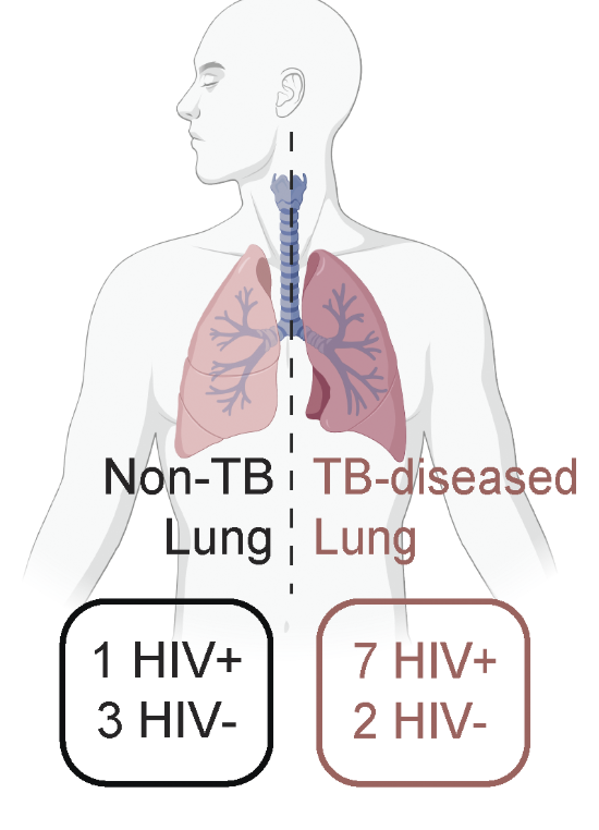 TB_lung.png